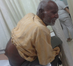 Spine Surgeon in Delhi